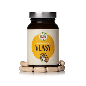 Vlasy